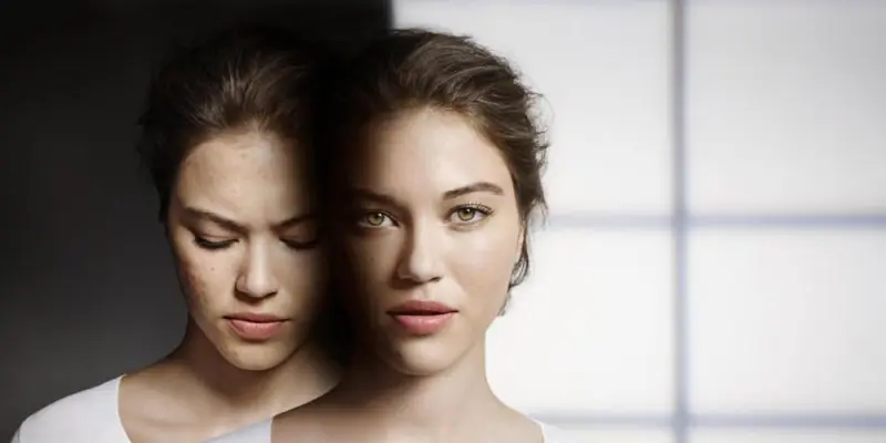 Hogyan alapozzuk a pattanásokra hajlamos bőrt?