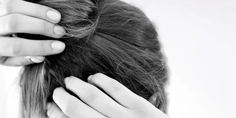 Száraz és viszkető fejbőr – Tünetek, kiváltó okok és kezelés