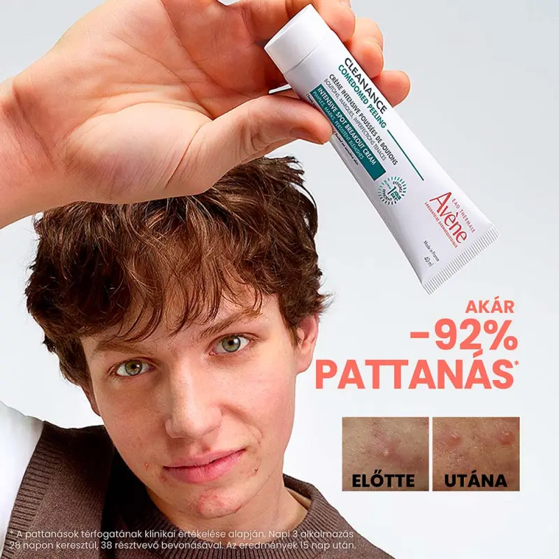 Cleanance Comedomed Peeling Intenzív Krém Pattanásokra 40 ml