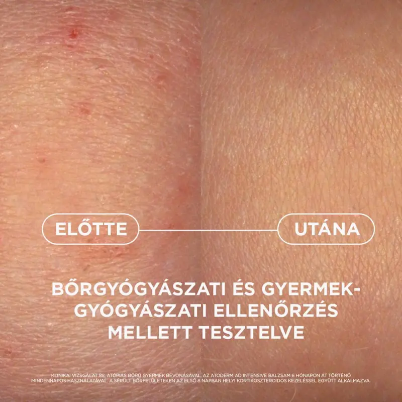 Atoderm AD Intensive Balzsam 400 ml