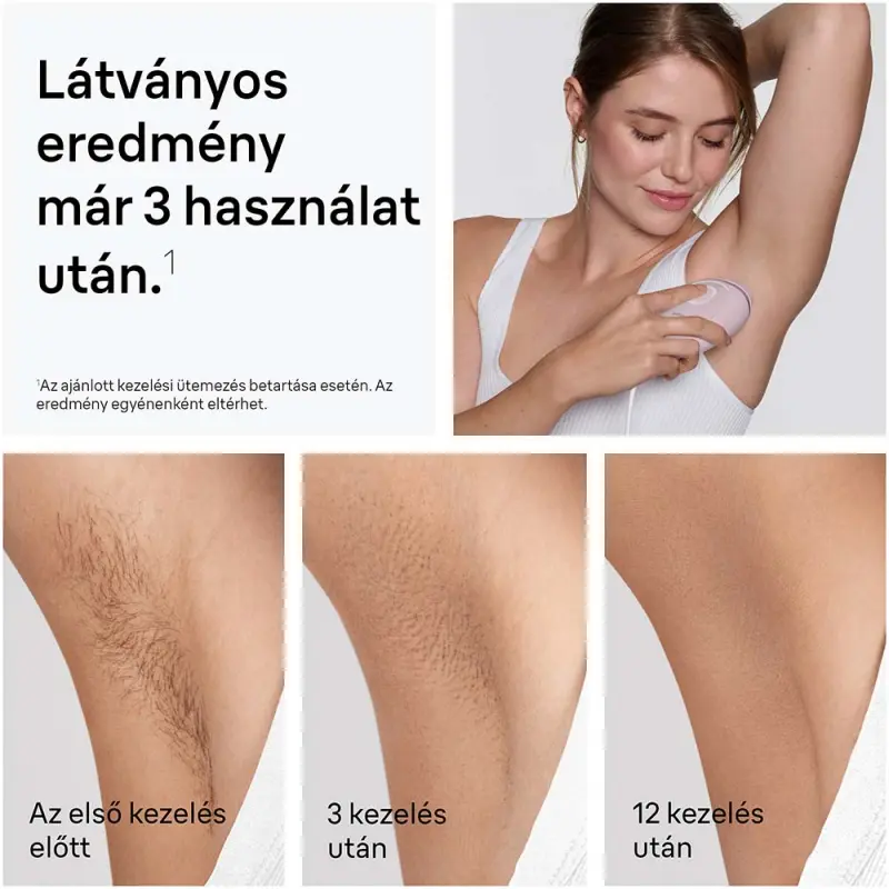 Silk-expert IPL PL1100 Villanófényes szőrtelenítő