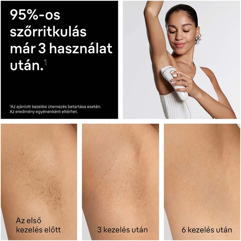 Silk-expert IPL PL5221 Villanófényes szőrtelenítő