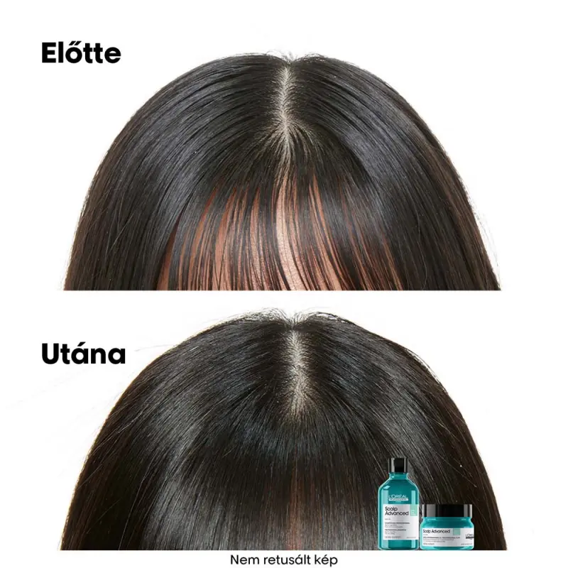 Scalp Advanced 2 az 1-ben zsírosodás elleni mélytisztító sampon (250 ml)