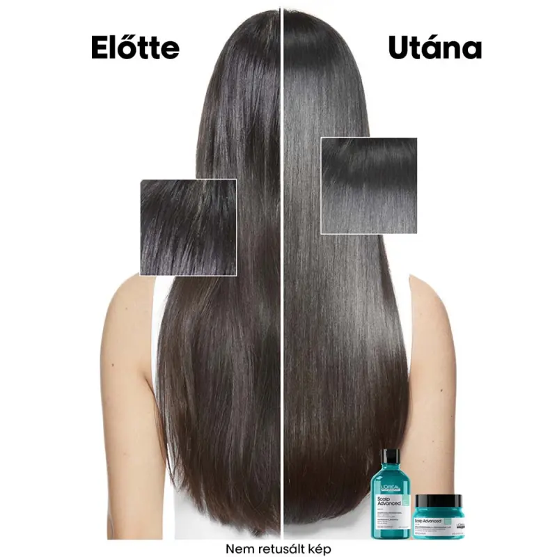 Scalp Advanced 2 az 1-ben zsírosodás elleni mélytisztító sampon (250 ml)
