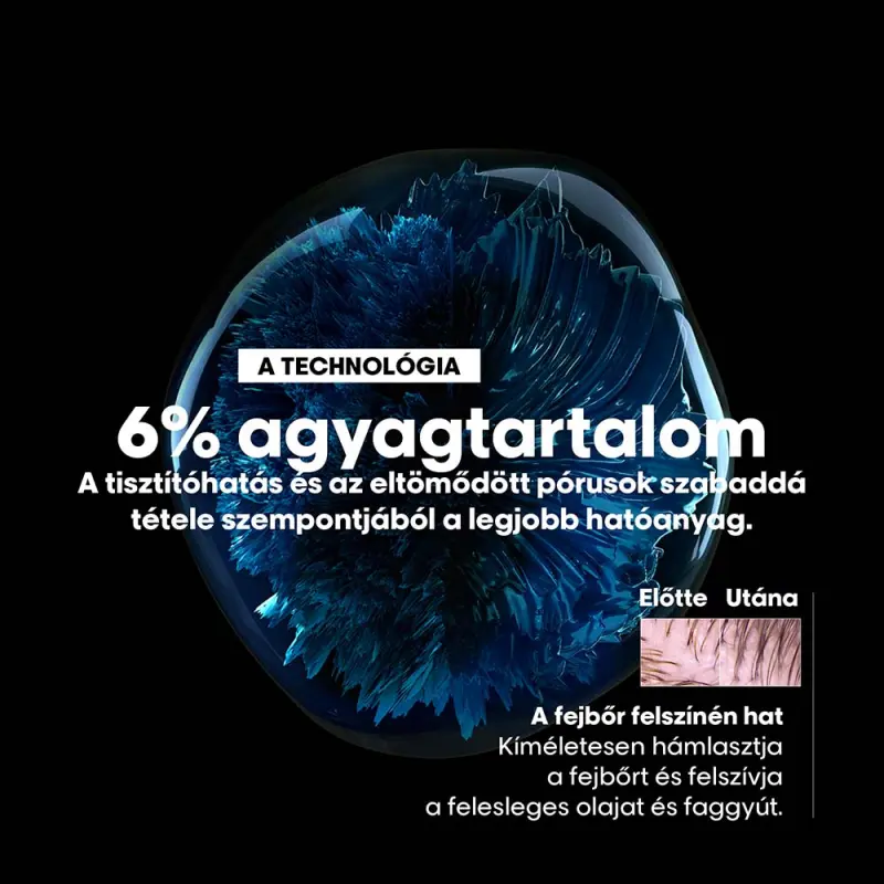 Scalp Advanced 2 az 1-ben zsírosodás elleni mélytisztító sampon (250 ml)