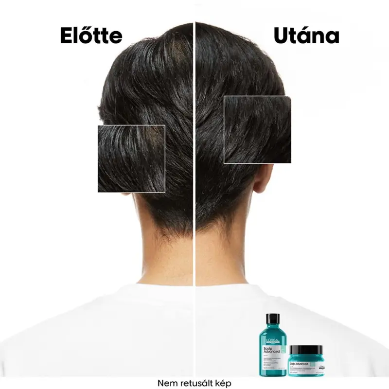 Scalp Advanced Anti-Discomfort Dermo-regulator fejbőrállapot szabályozó sampon (300 ml)
