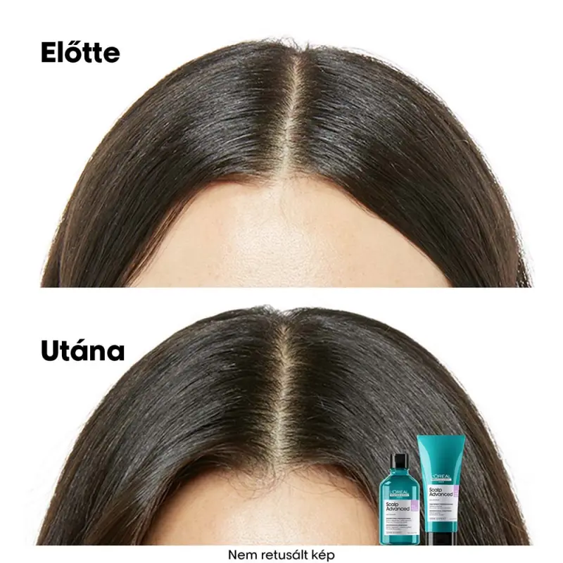 Scalp Advanced Anti-Discomfort Dermo-regulator fejbőrállapot szabályozó sampon (500 ml)