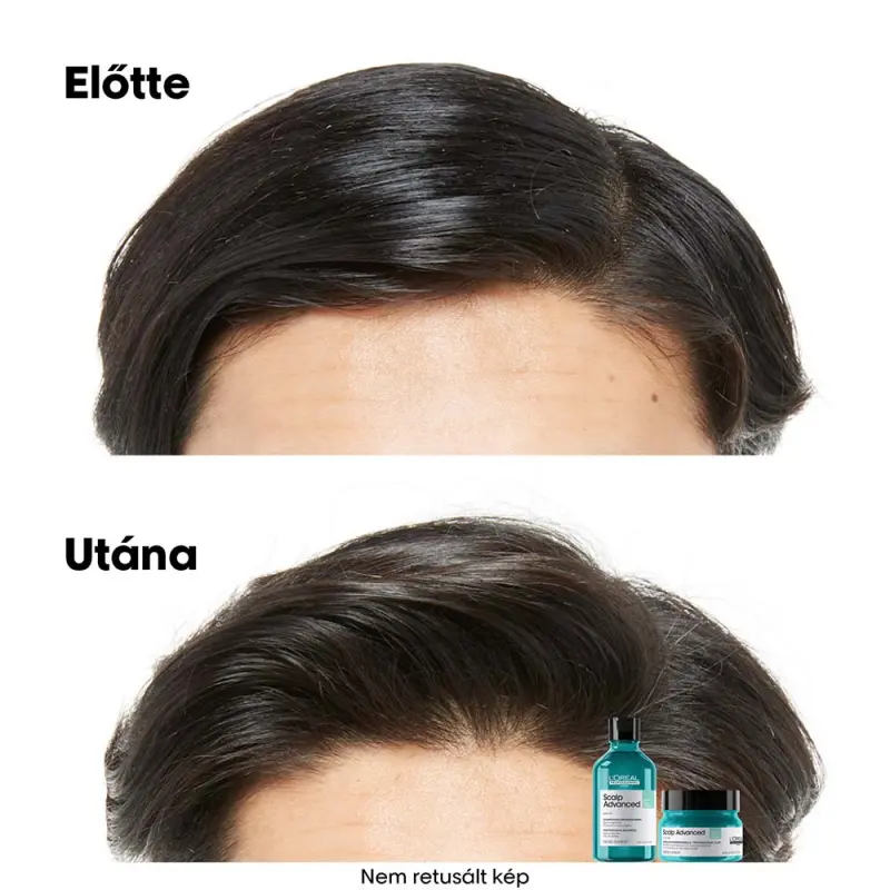 Scalp Advanced Anti-Discomfort Dermo-regulator fejbőrállapot szabályozó sampon (500 ml)