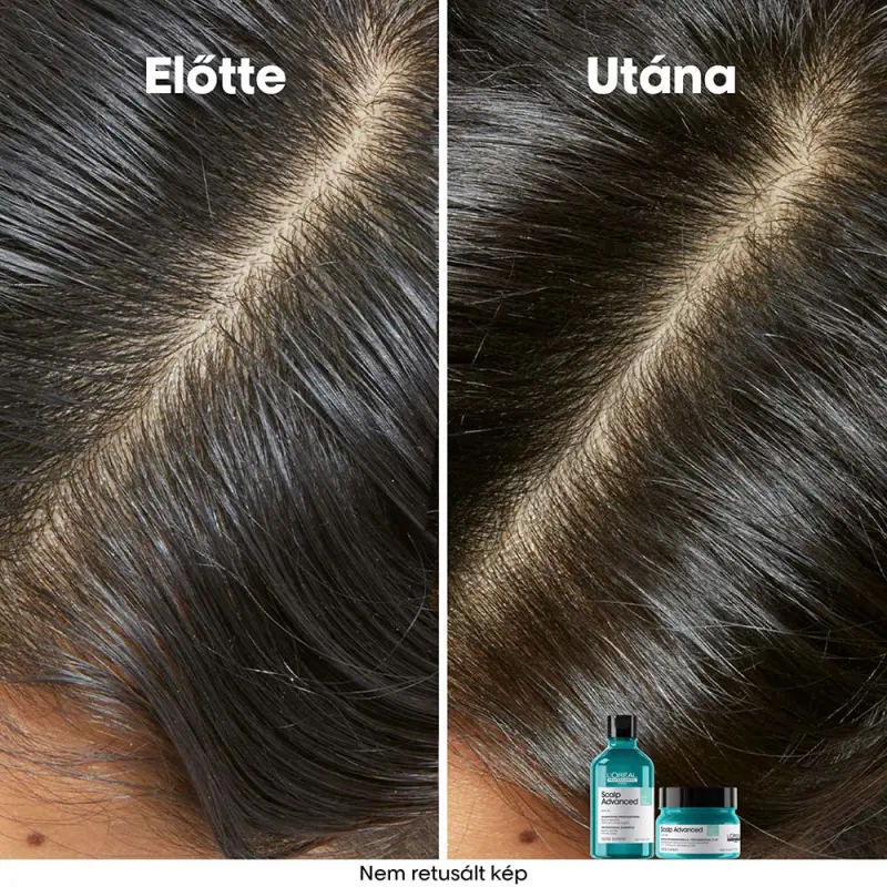 Scalp Advanced Anti-Discomfort Dermo-regulator fejbőrállapot szabályozó sampon UTÁNTÖLTŐ (500 ml)