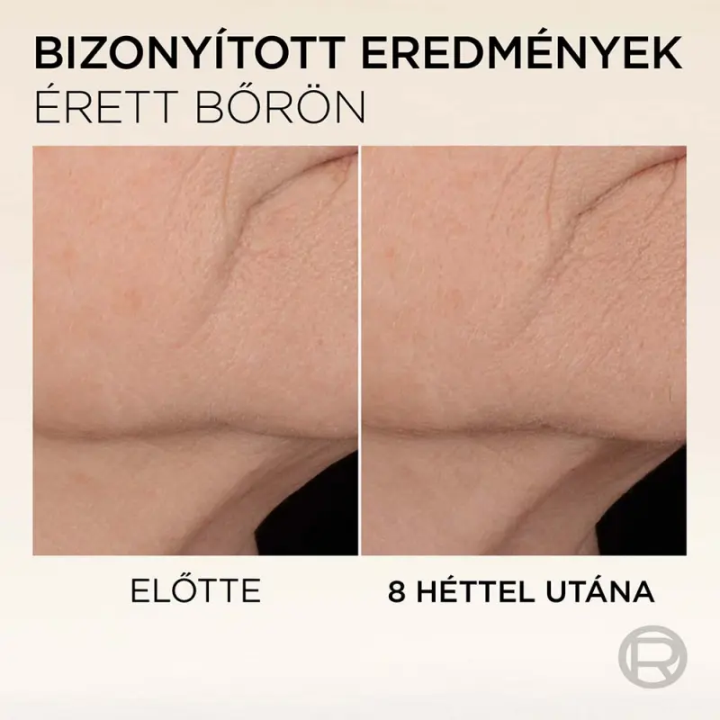 Age Perfect Feszesítő szérum megereszkedett bőrre 30 ml