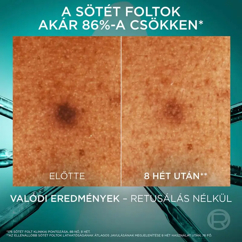 Bright Reveal sötét foltok elleni szérum niacinamiddal 30 ml