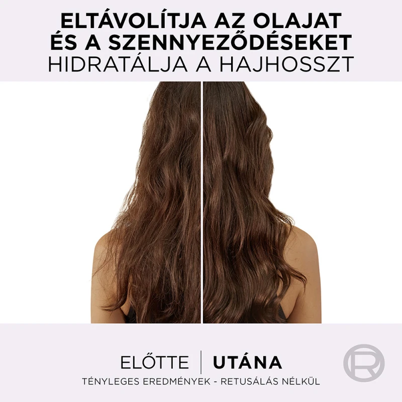 Elseve Hyaluron Pure fejbőrszérum 102 ml