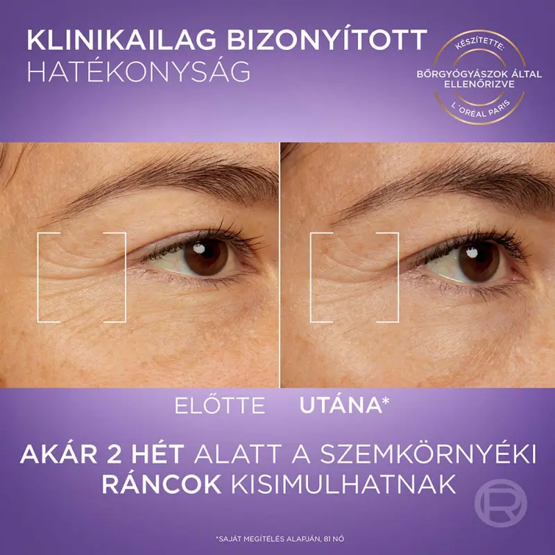 Revitalift Filler szemszérum (20 ml)