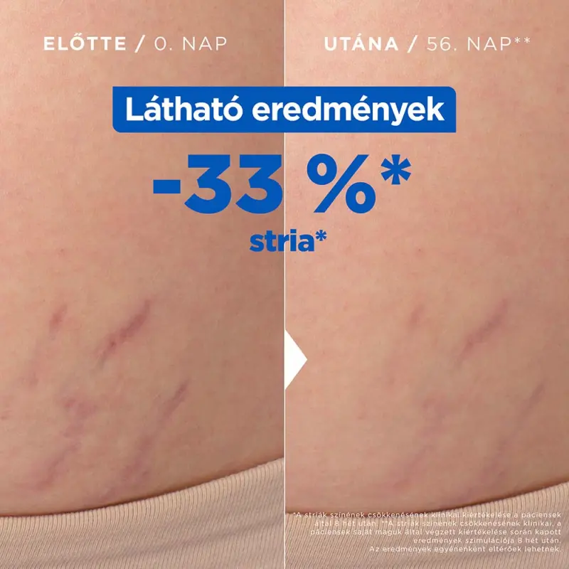 Striák elleni olaj 100 ml