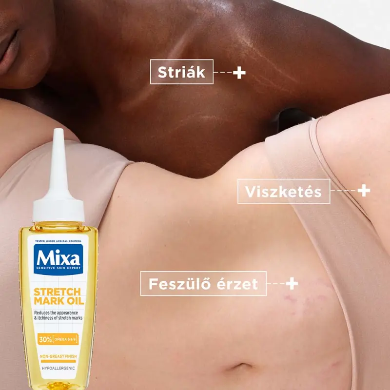 Striák elleni olaj 100 ml
