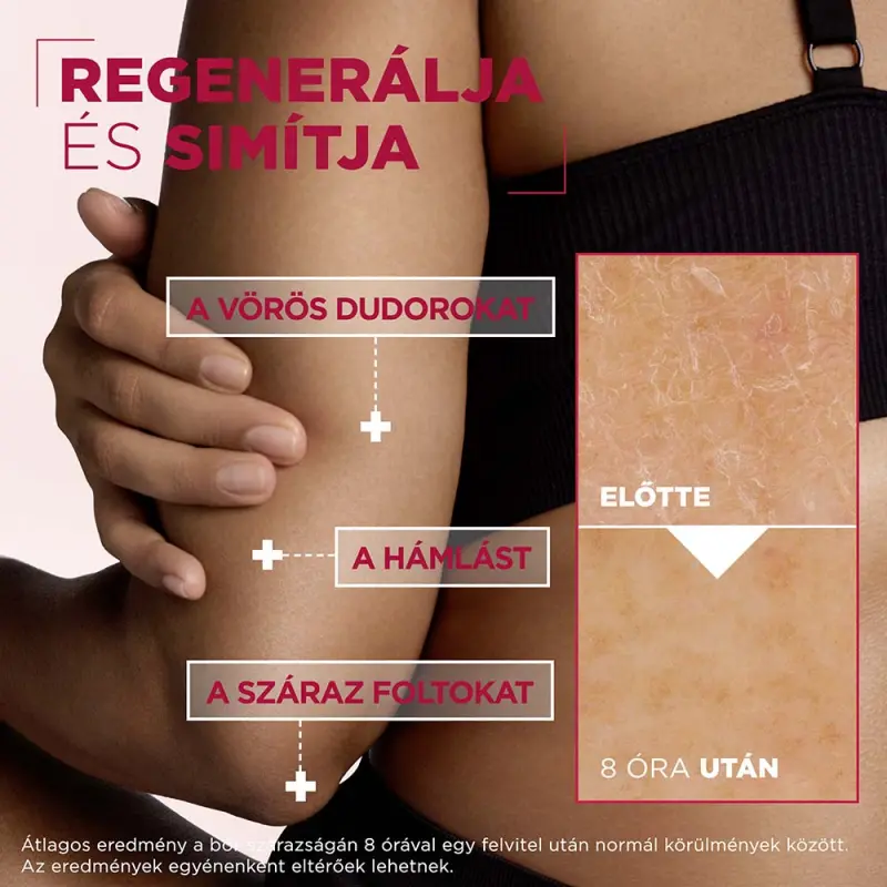 Urea Cica Repair+ regeneráló testápoló száraz, durva bőrre 150 ml