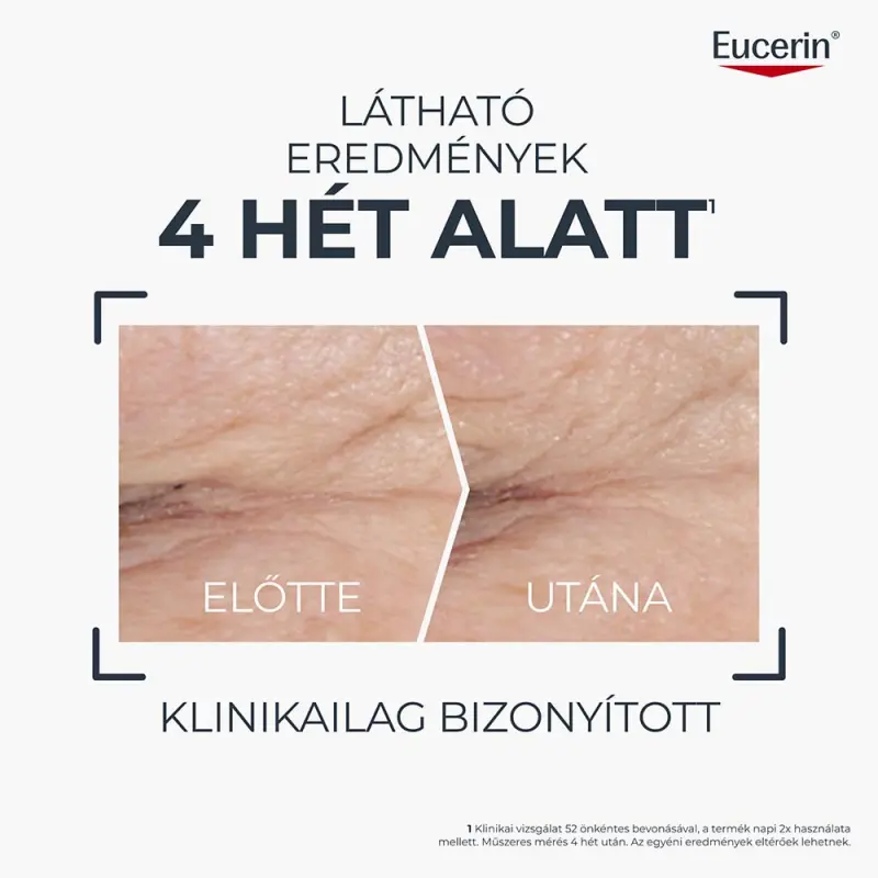 Hyaluron-Filler + Longevity Epigenetic Nappali arcápoló SPF30 (50 ml)