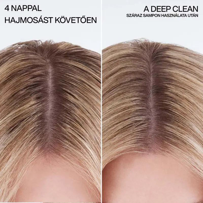 Dry Shampoo - Száraz sampon 91 g