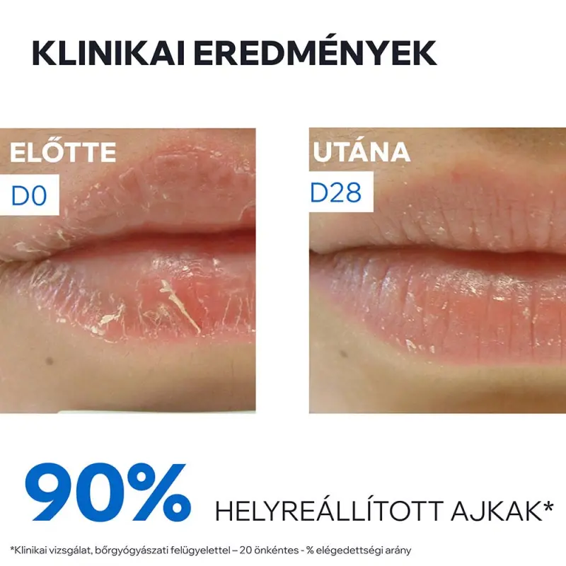 BARIÉDERM CICA ajakápoló balzsam 2x15 ml