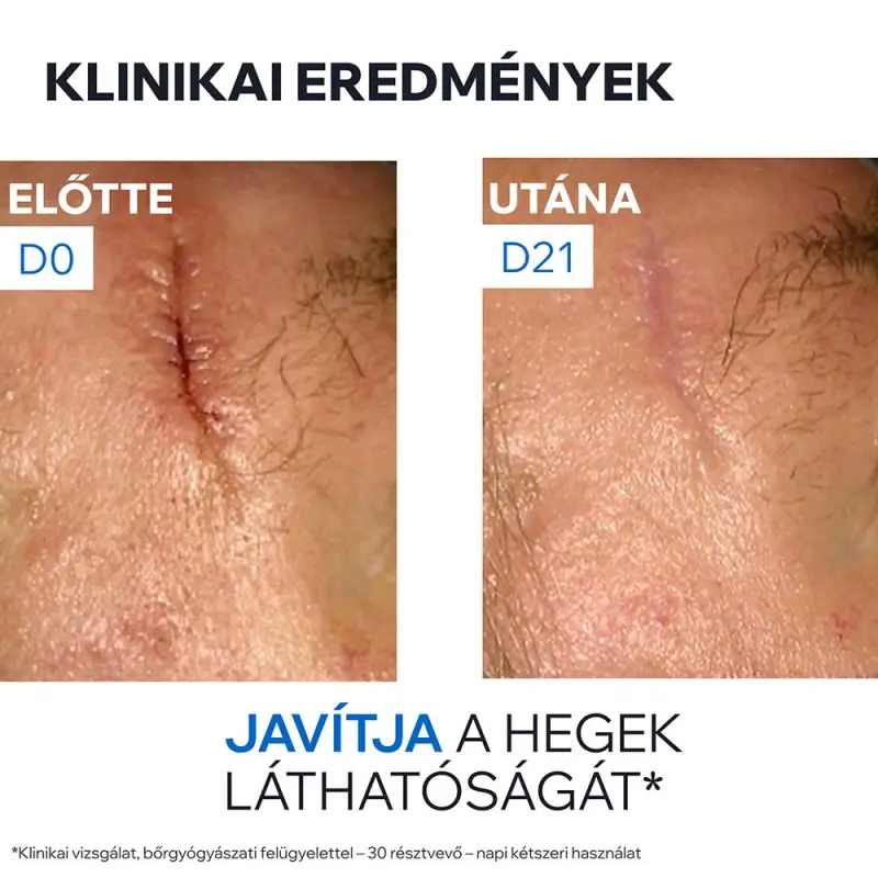 BARIÉDERM CICA CU-ZN+ Sebkezelő és gyulladáscsökkentő krém 15 ml