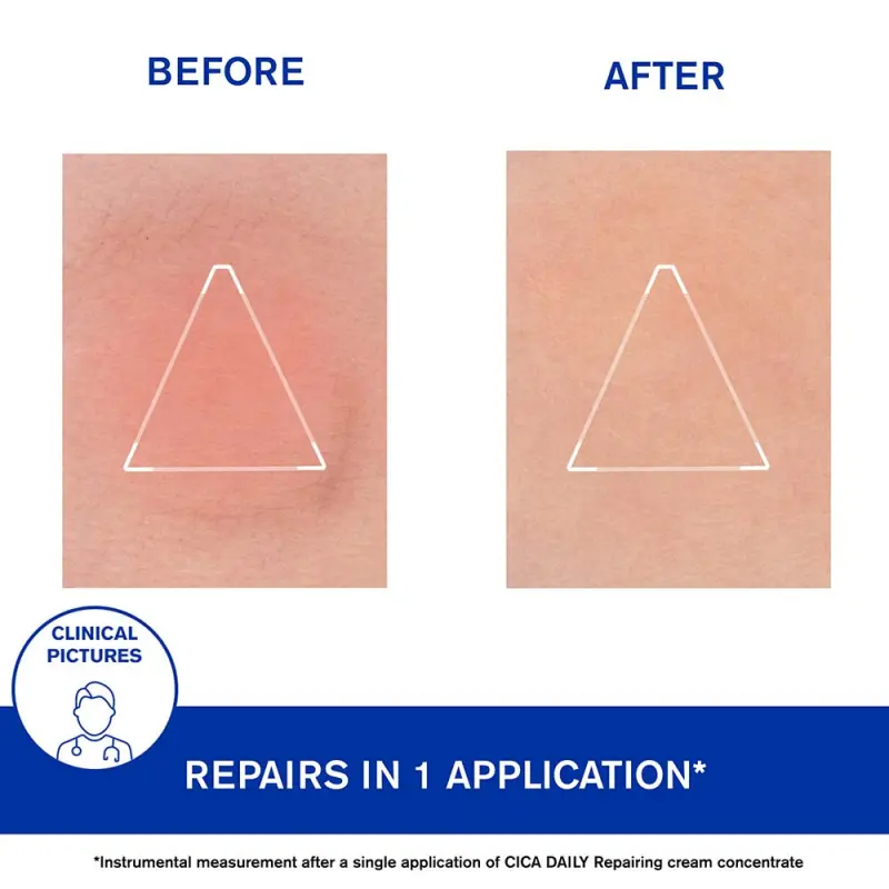 Bariéderm CICA DAILY Regeneráló arcápoló koncentrátum krém UTÁNTÖLTŐ 50 ml