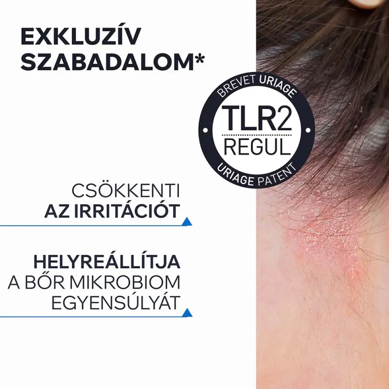 D.S. HAIR Intenzív sampon erősen korpás fejbőrre 150 ml