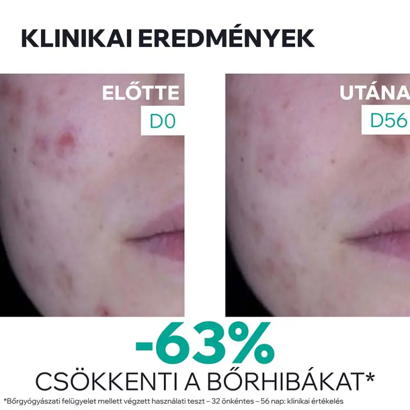 HYSÉAC 3-REGUL+ Krém mitesszerekre és pattanásokra 40 ml