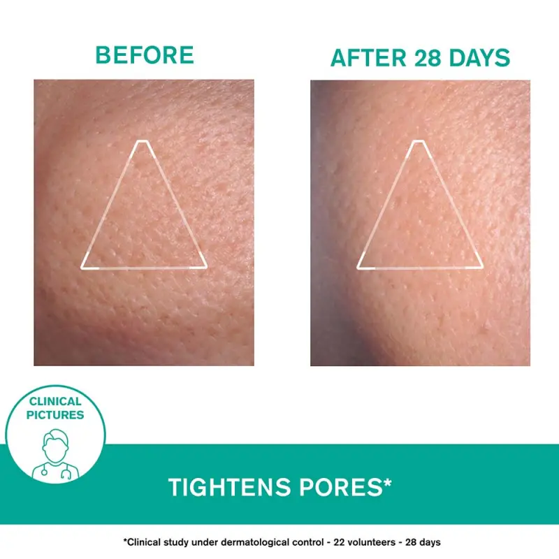 HYSÉAC MAT mattító krém zsíros bőrre 40 ml