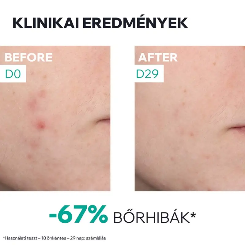 HYSÉAC NEW SKIN BOOSTER Szérum bőrhibák ellen 30 ml