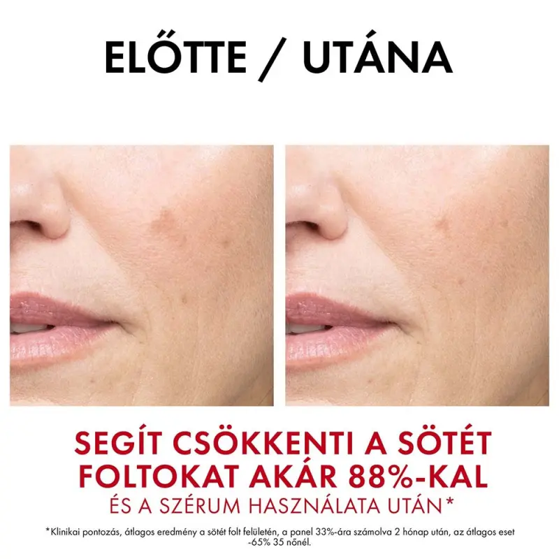 Liftactiv Pigment Specialist B3 nappali krém SPF50 (50 ml)