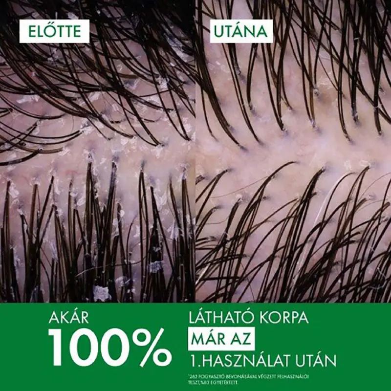 Dercos Korpásodás elleni sampon normál és zsíros hajra utántöltő 390 ml