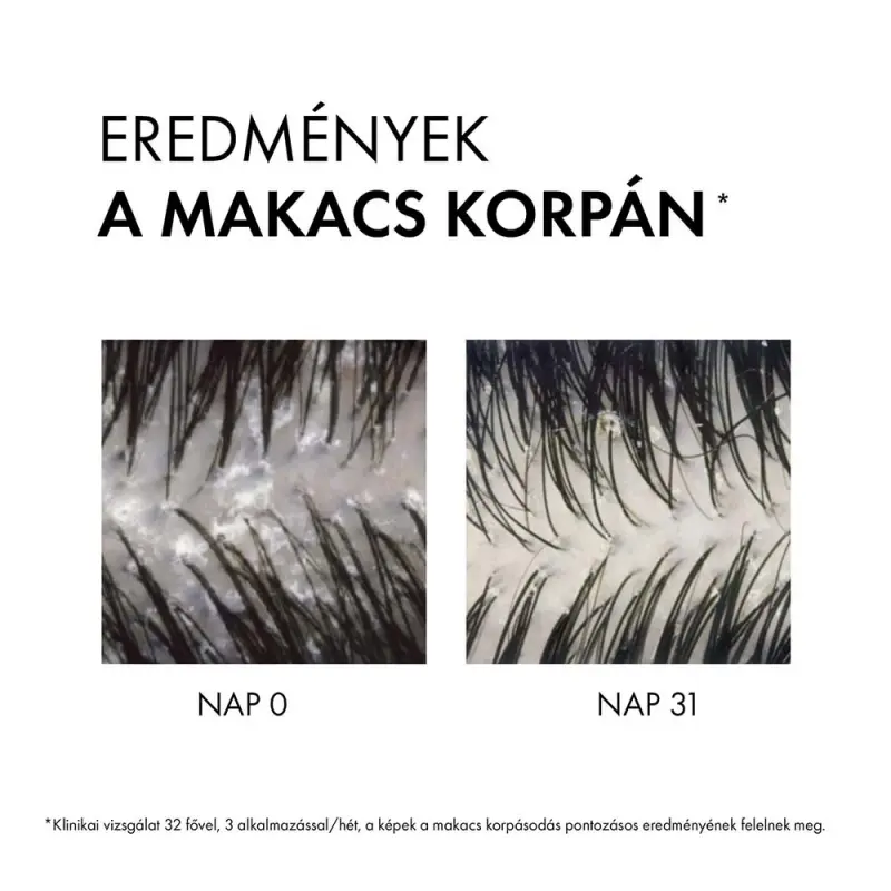 Dercos Korpásodás elleni sampon száraz hajra utántöltő 390 ml