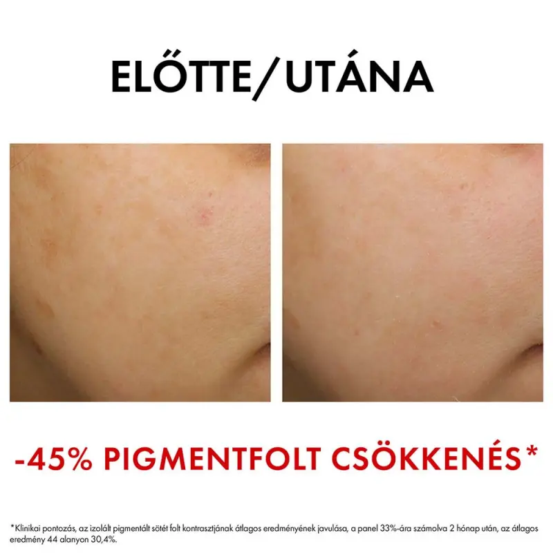 Liftactiv Pigment Specialist B3 Bőrtónus korrigáló éjszakai arckrém tiszta retinollal 50 ml